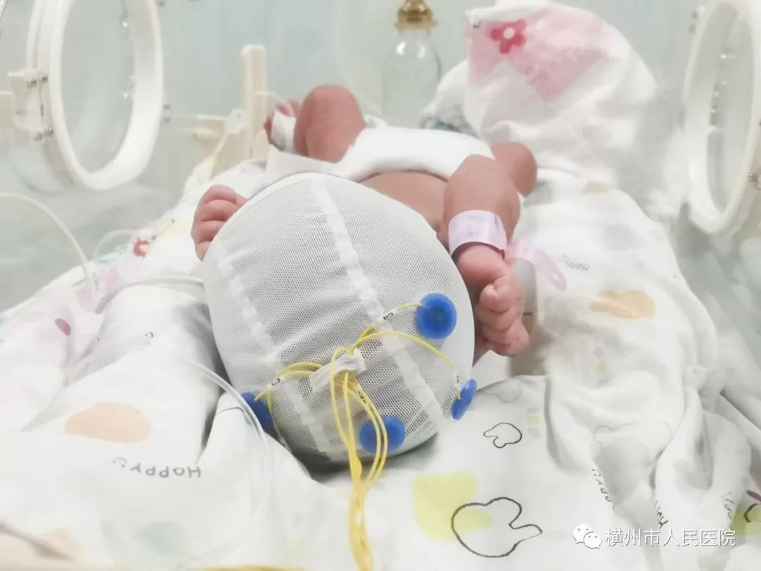 脑电监护仪什么牌子好新生儿振幅整合脑电图，有效了解新生儿健康_https://www.jmylbn.com_新闻资讯_第13张