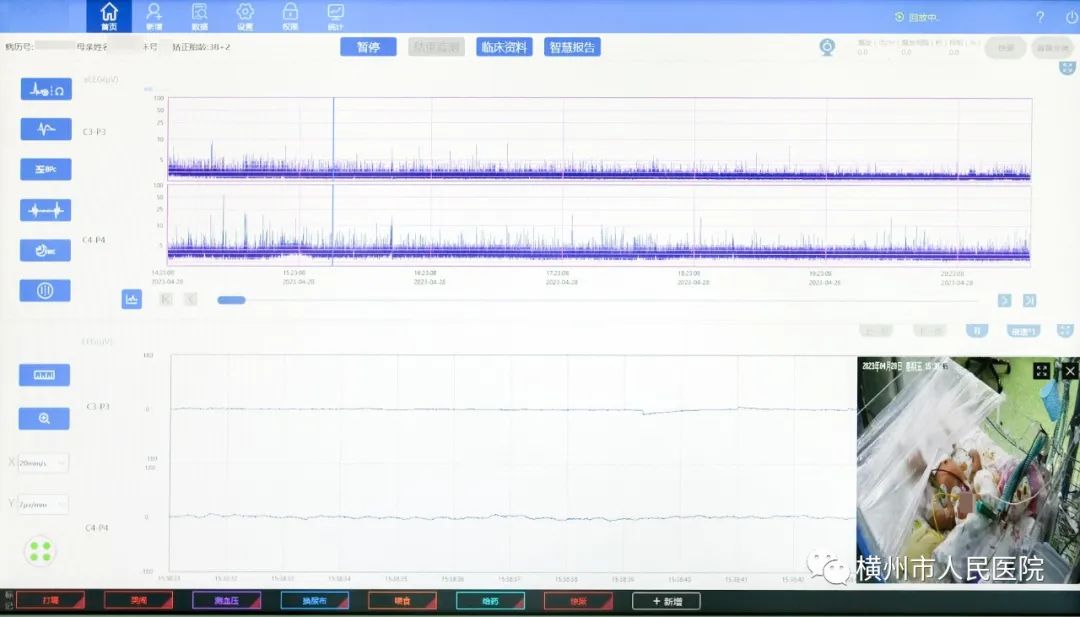 脑电监护仪什么牌子好新生儿振幅整合脑电图，有效了解新生儿健康_https://www.jmylbn.com_新闻资讯_第11张