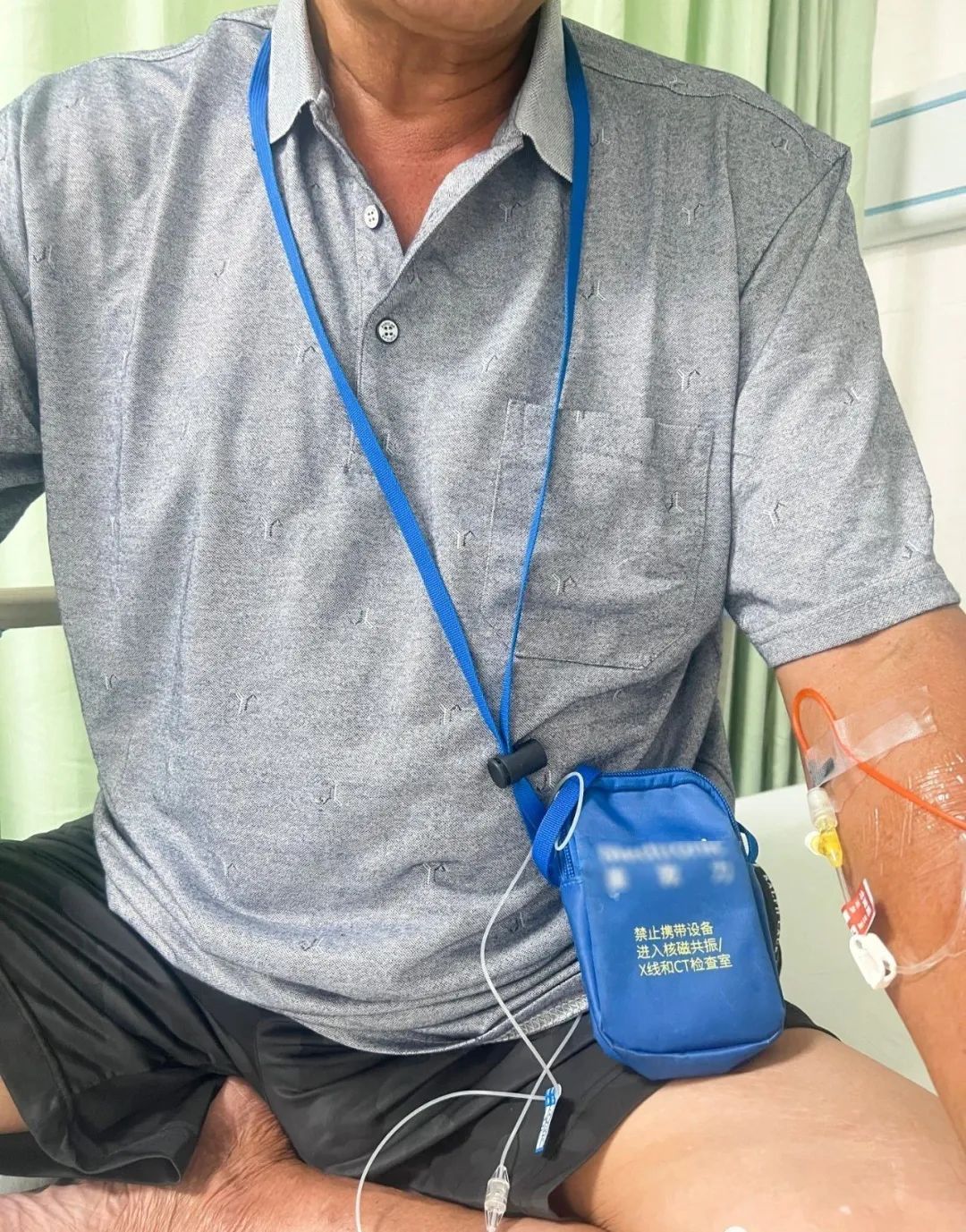 医疗泵什么“糖友”的福音——科外胰岛素泵治疗_https://www.jmylbn.com_新闻资讯_第10张