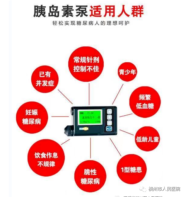 医疗泵什么“糖友”的福音——科外胰岛素泵治疗_https://www.jmylbn.com_新闻资讯_第12张