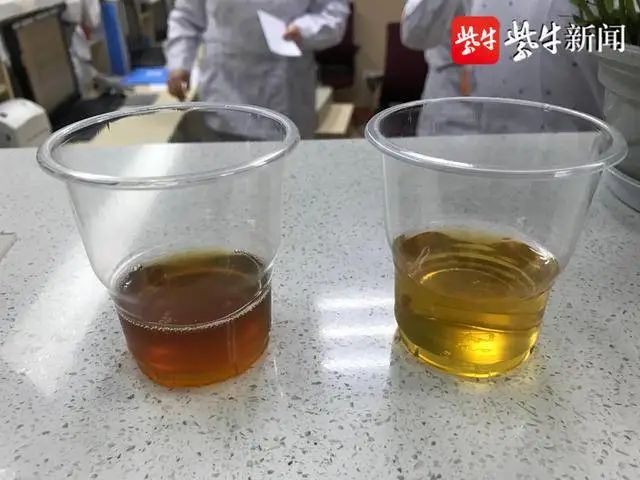 左边为酱油尿尿样,右边为正常尿样眼下正是蚕豆上市的季节,蚕豆病在