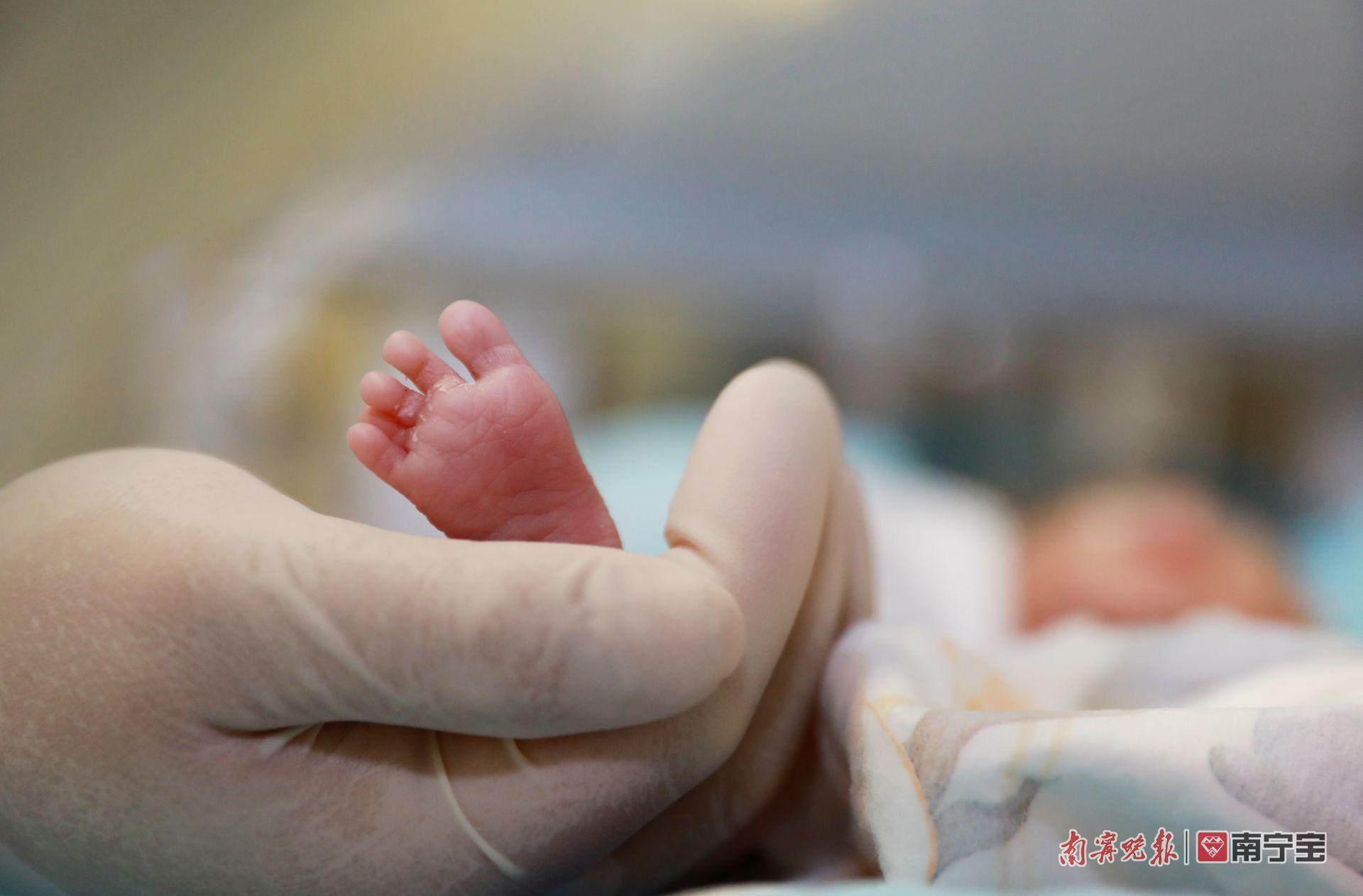 为什么新生儿抢救台出生时仅600克！市二医院新生儿科成功救治超早产“巴掌宝宝”_https://www.jmylbn.com_新闻资讯_第3张